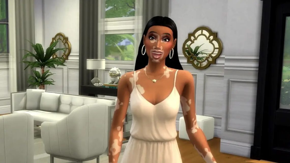 The Sims 4'e Vitiligo Görünüşü Ekleniyor