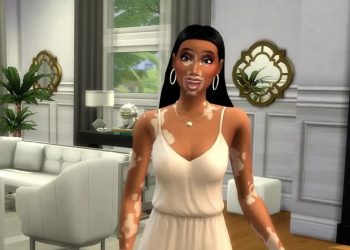The Sims 4'e Vitiligo Görünüşü Ekleniyor